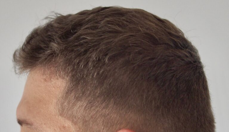 Zdjęcie z przodu - przykład