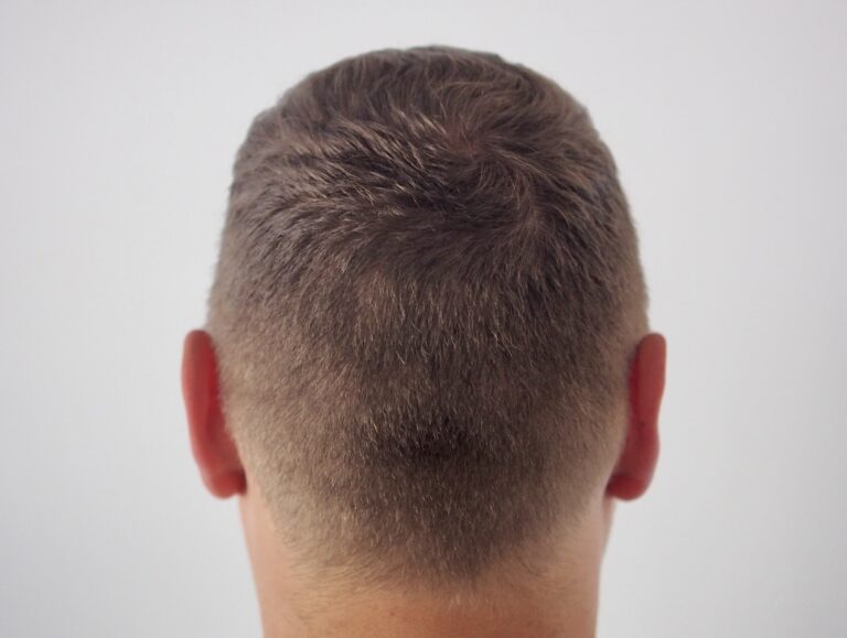 Zdjęcie z boku - przykład