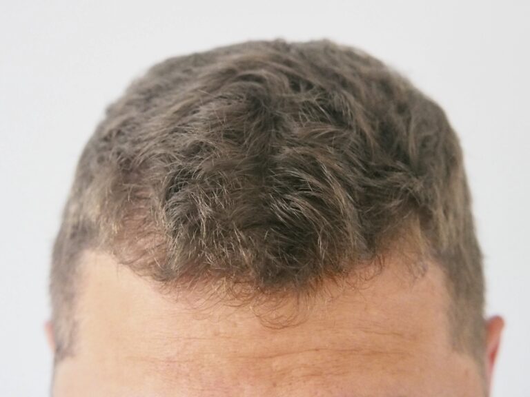 Zdjęcie z tyłu - przykład