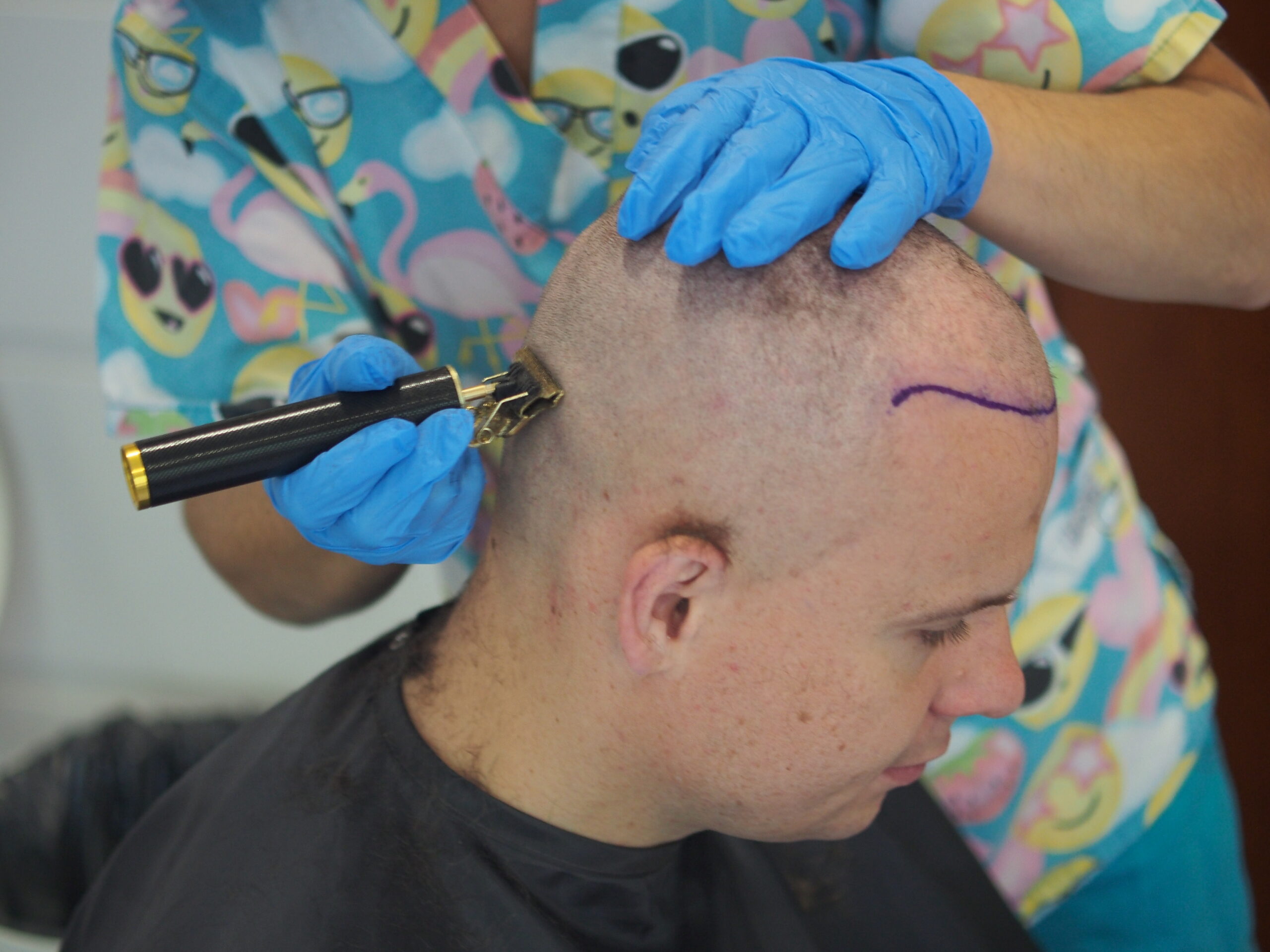 Golenie głowy do zabiegu