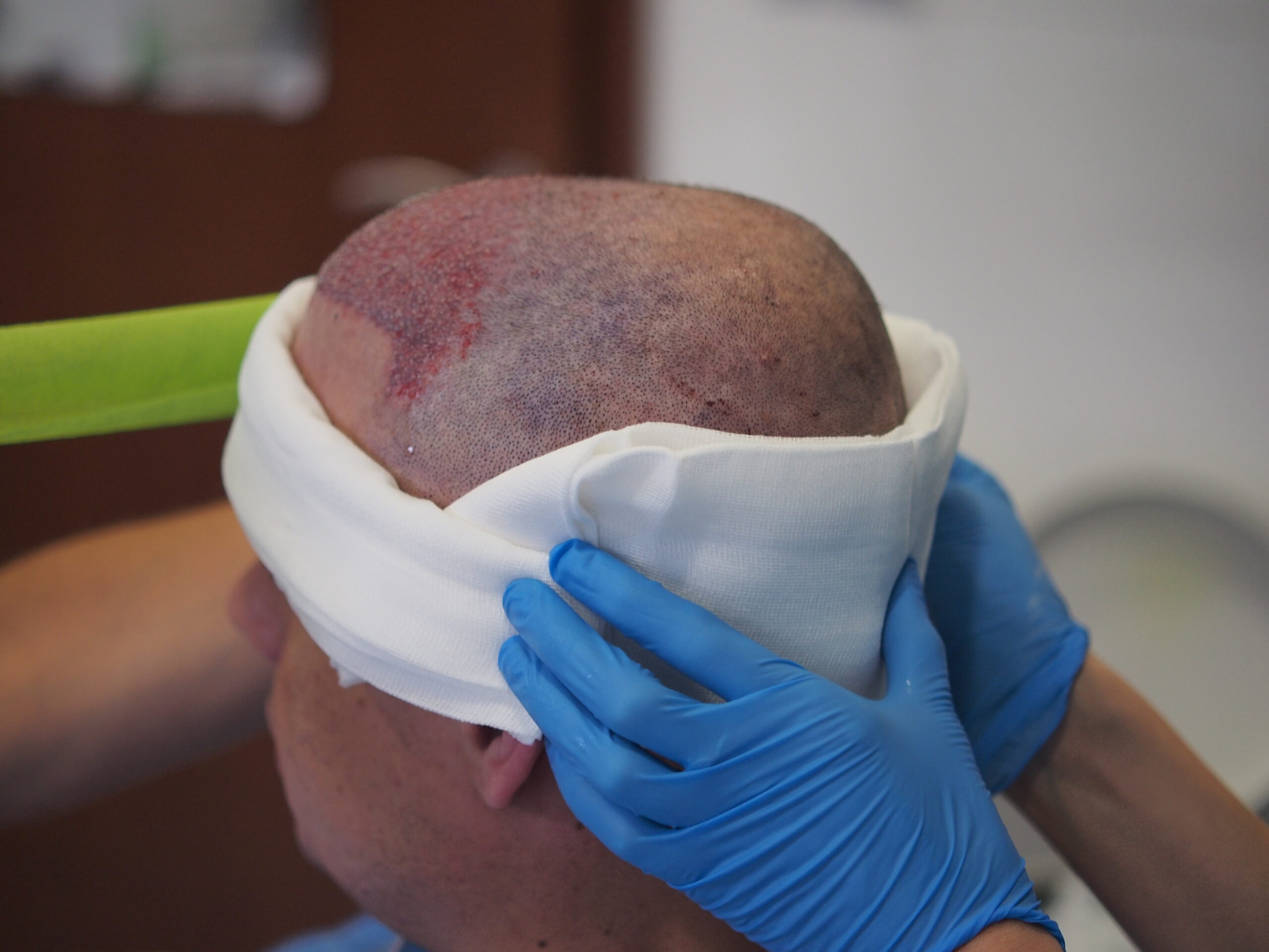 Opatrunek po zabiegu